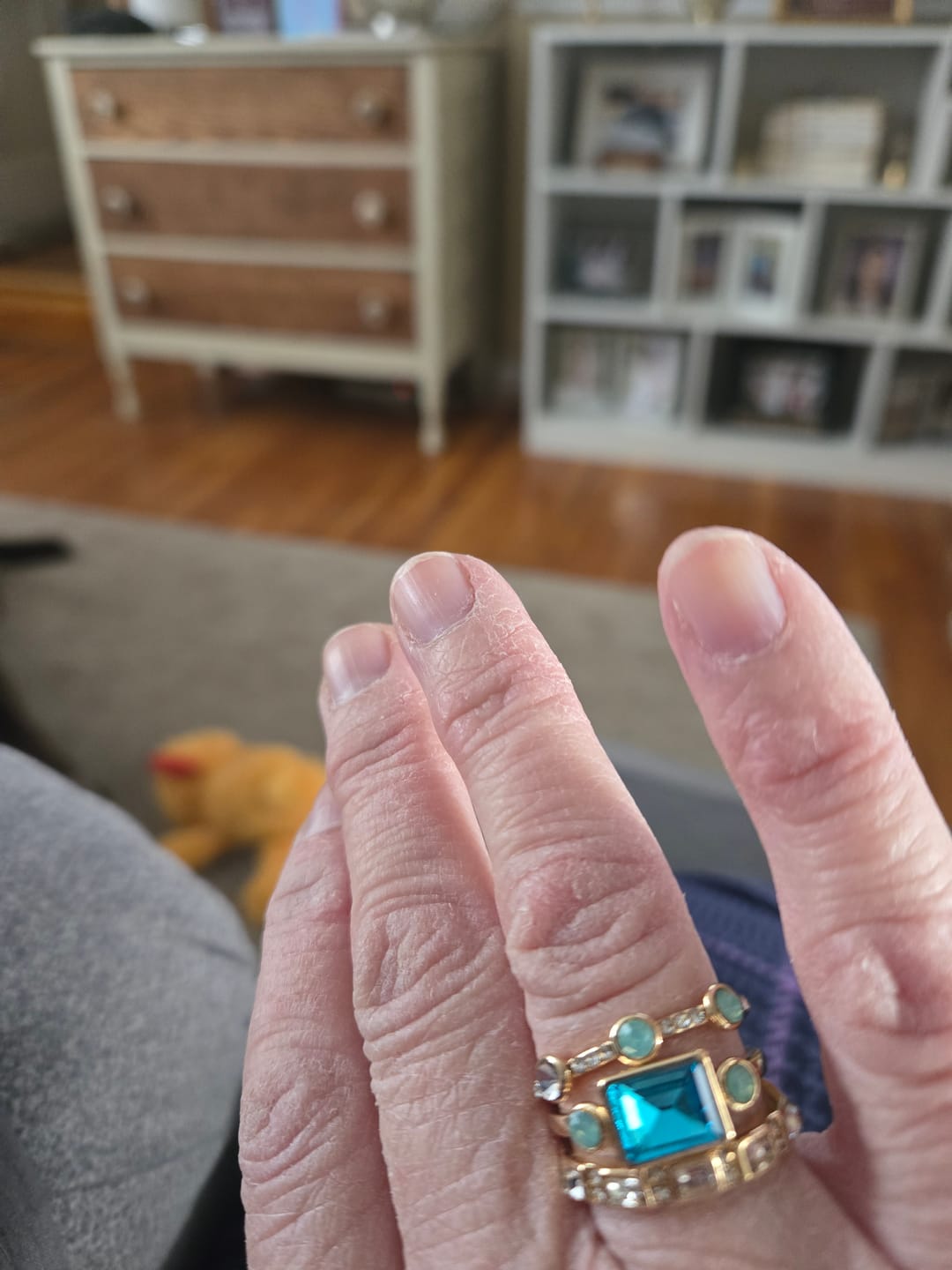 Customer photo review of Luxury 3PC Gold Color Trendy Ring