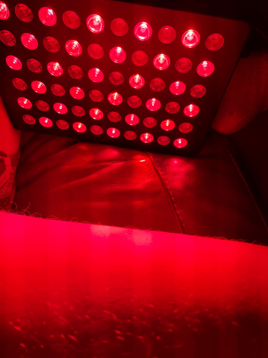 Customer photo review of Koanna® Luma300™ – Powerful, Compact Red Light Therapy Panel