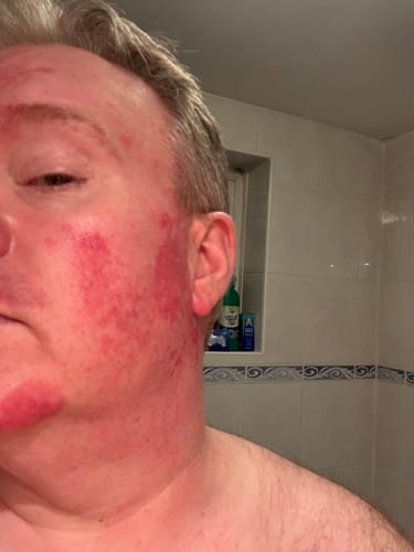 Customer photo review of Seb Natural Calming Serum