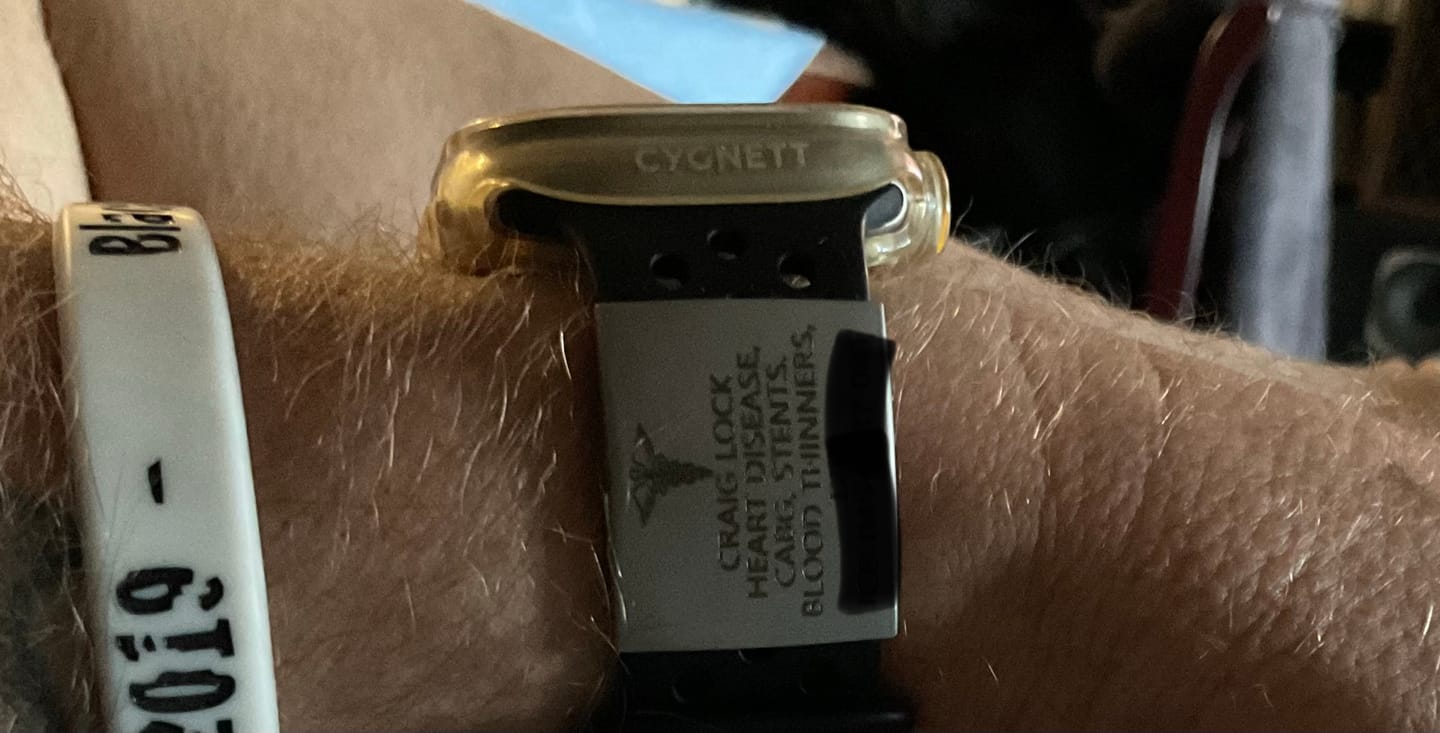 Customer photo review of Personalised ID Tag for Watch Band & Fitness Trackers
