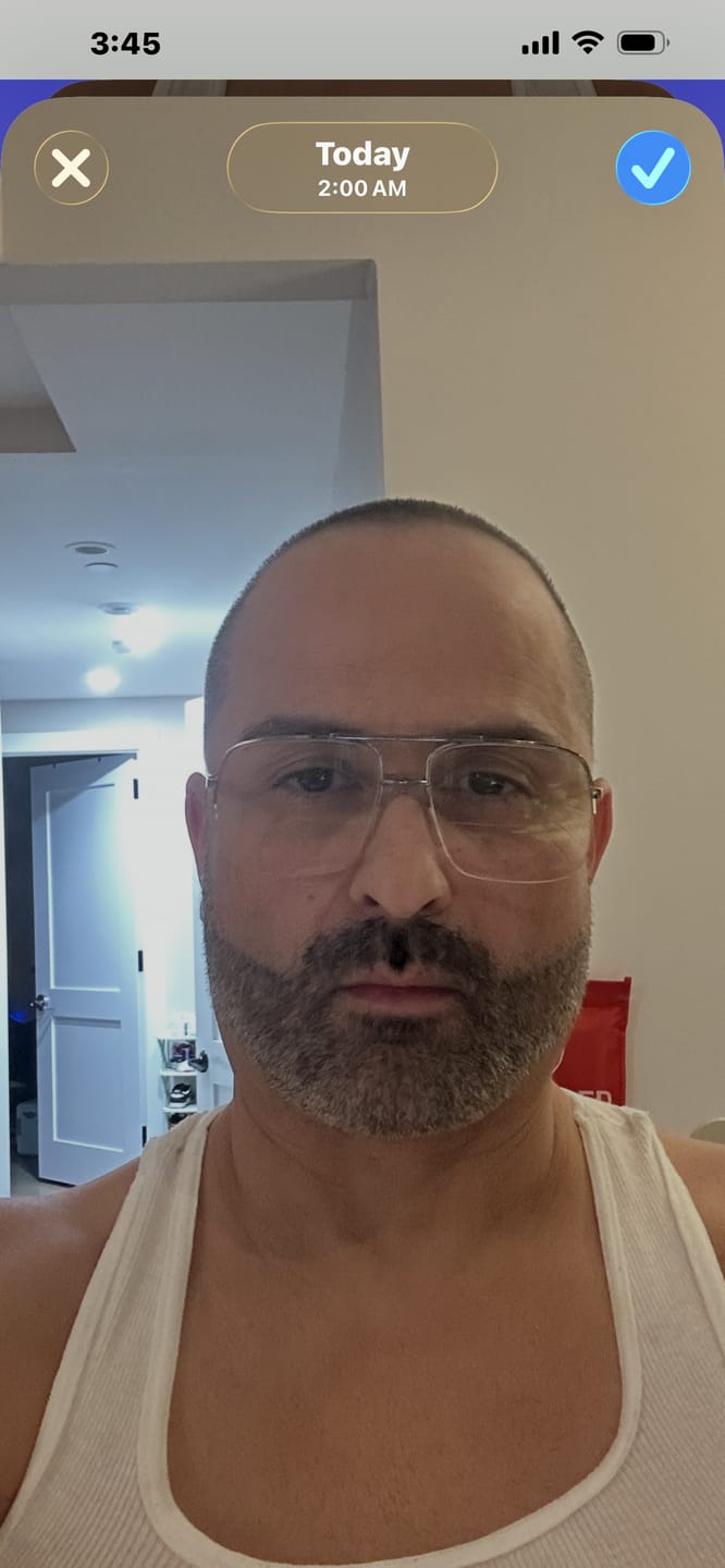 Customer photo review of Hair & Beard Touch Up Powder – Instantly Covers Gray Hair, Bald Spots & Patchy Beards – Water-Resistant, Natural Finish – Black – 4g Color Kit Haircare