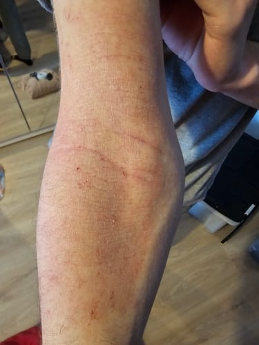 Customer photo review of Seb Natural Calming Serum