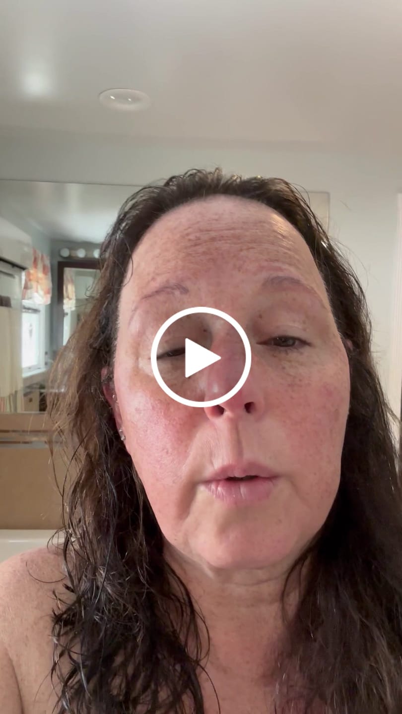 Customer video review of Glov Micro Infusion System