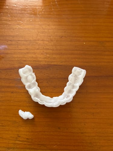 Customer photo review of Official SnapOn Veneers