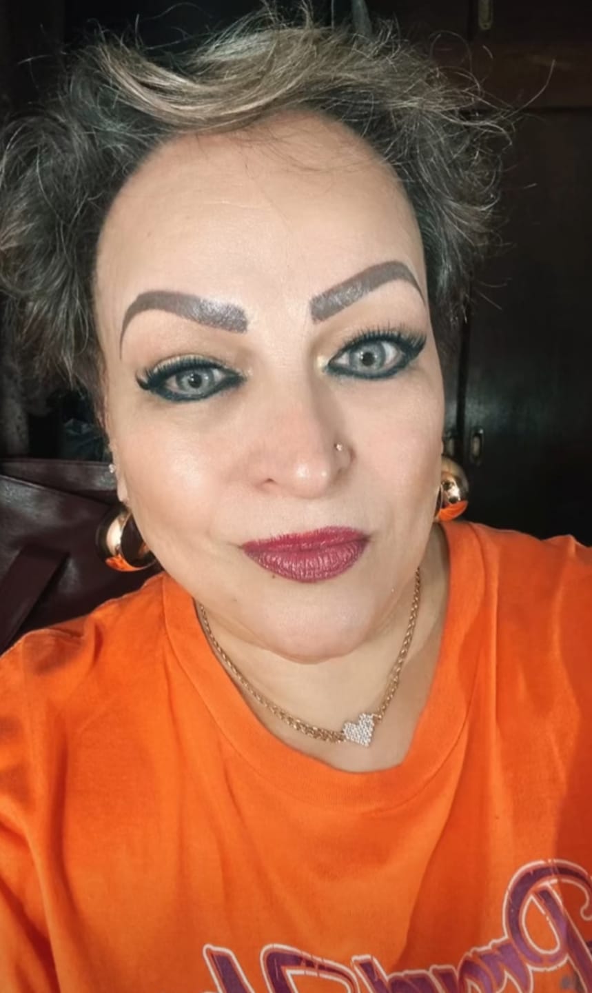 Customer photo review of Amazonia Icy Volcano Gray Prescription Colored Contact Lenses