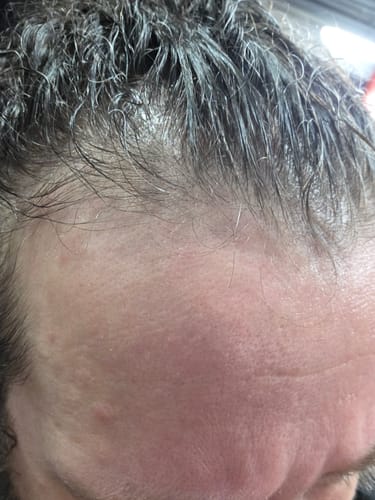 Customer photo review of Seb Natural Calming Serum