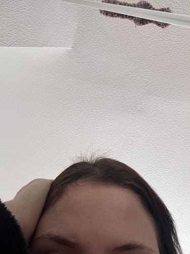 Customer photo review of VITAFOAM ™ Hair Growth Formula