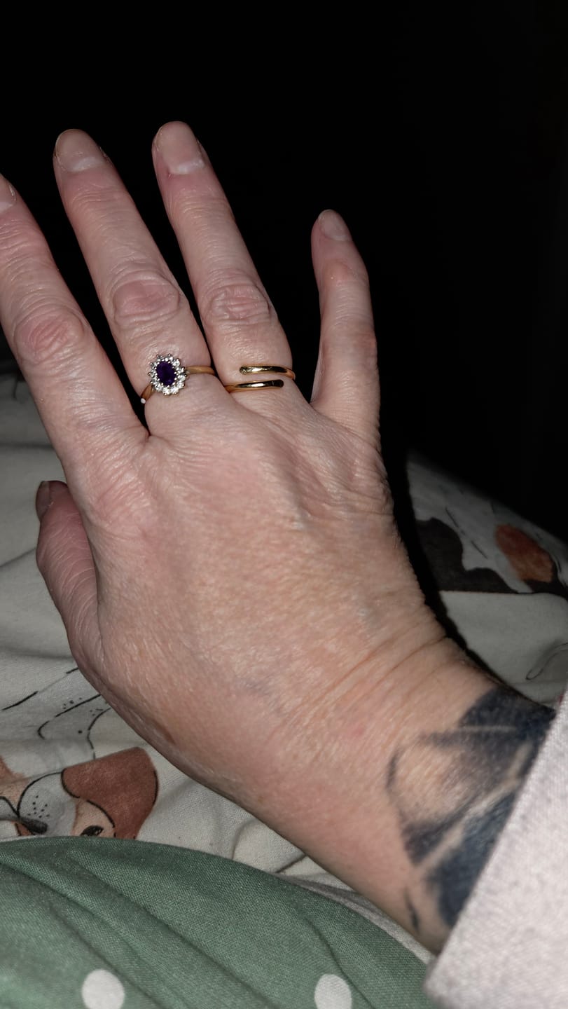 Customer photo review of 14K Gold Wrap Ring