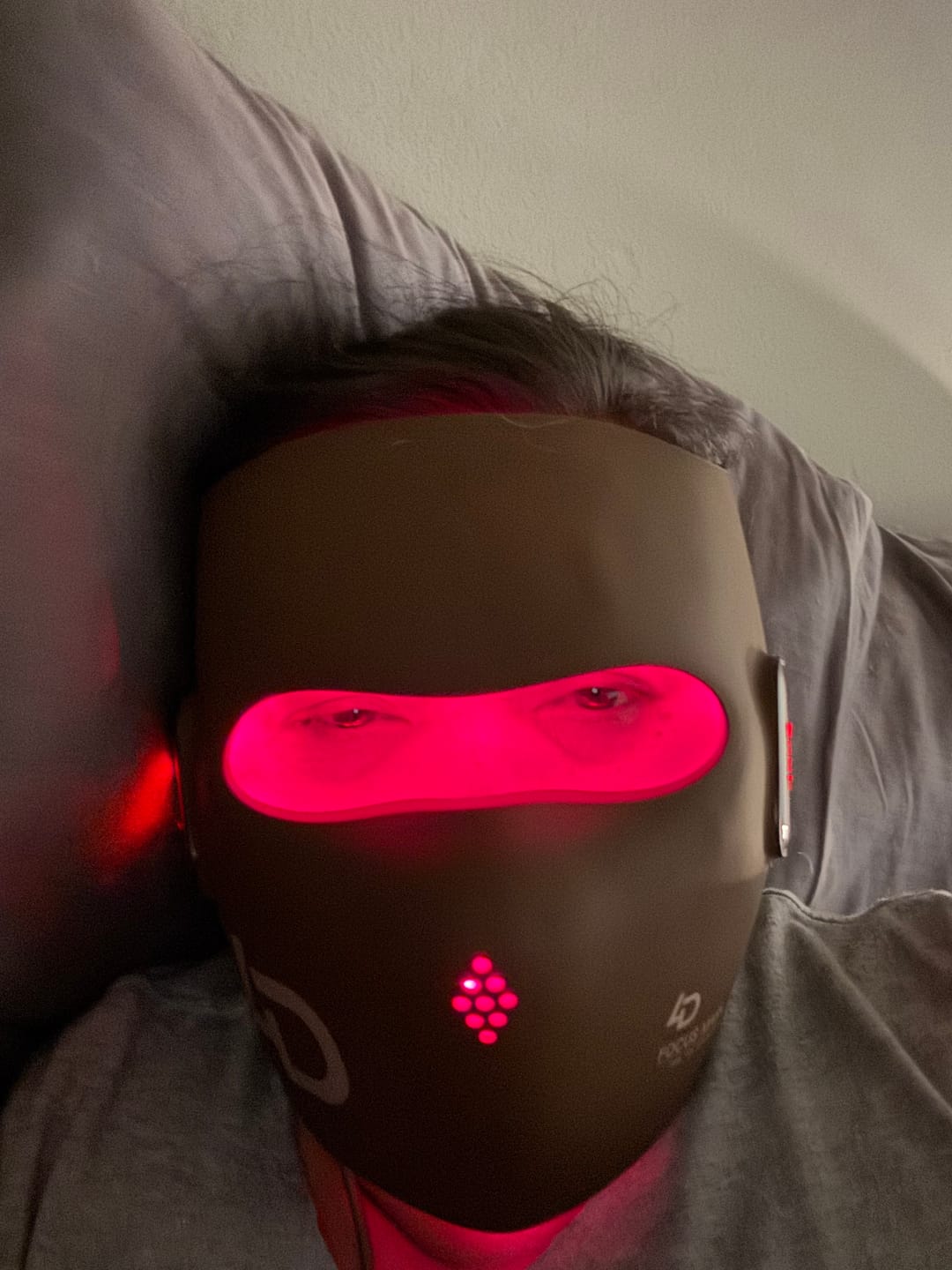 Customer photo review of JOVS 4D Laser Anti-Aging Therapy Mask