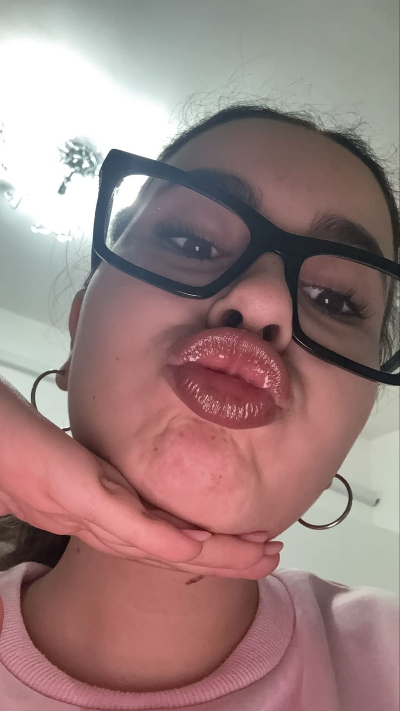Customer photo review of Lip Jelly