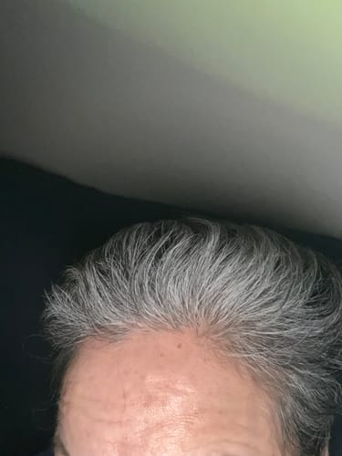 Customer photo review of Ultimate Hair Strength PRO Supplements- 90 Days