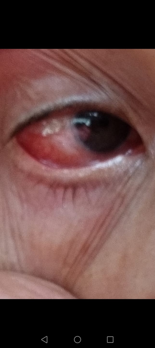 Customer photo review of Picături sterile oftalmice Kamaeyesvet 5 ml
