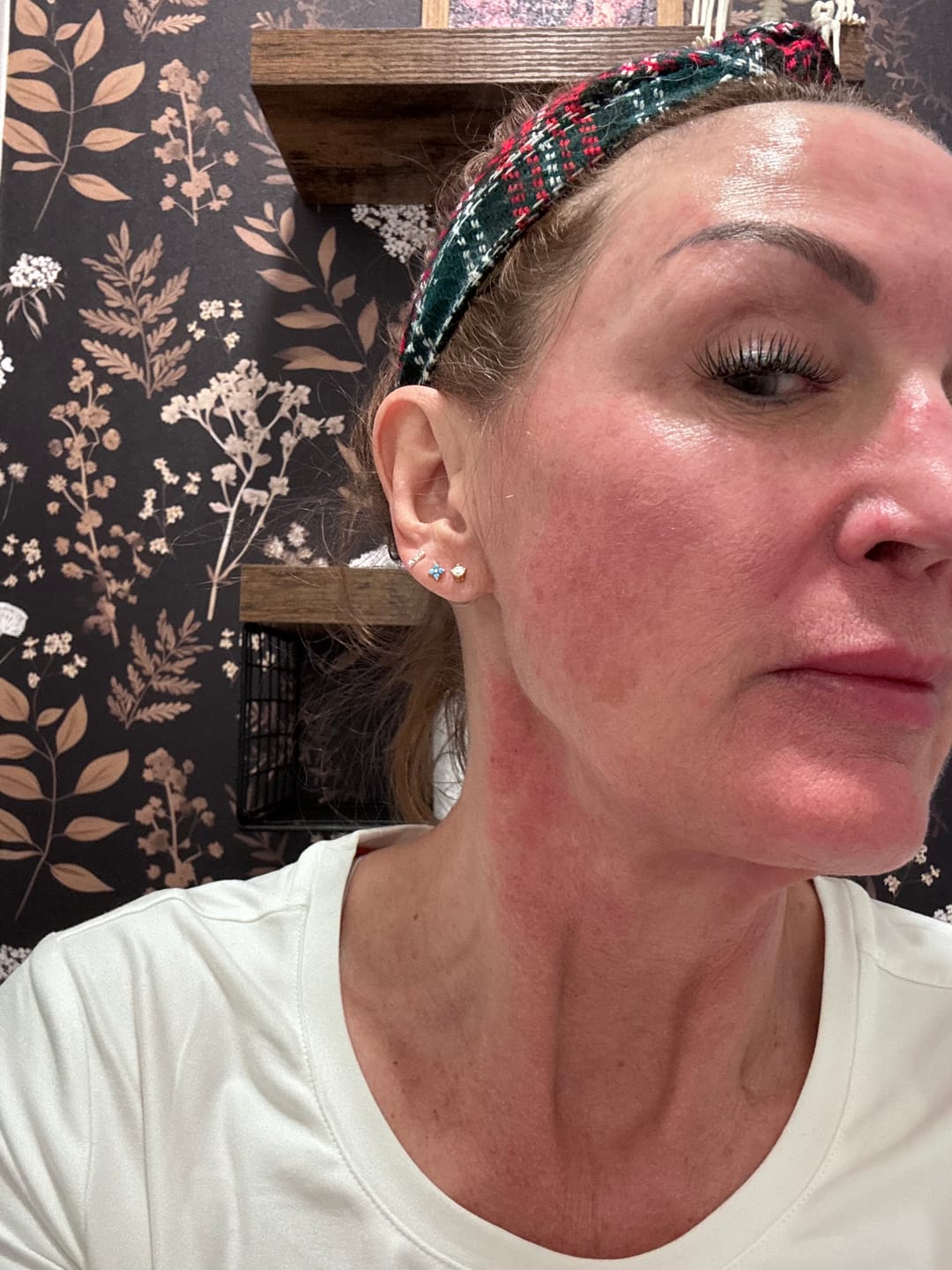 Customer photo review of Glov Micro Infusion System