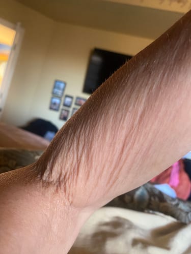 Customer photo review of Besque® Magic Body Oil - Unscented