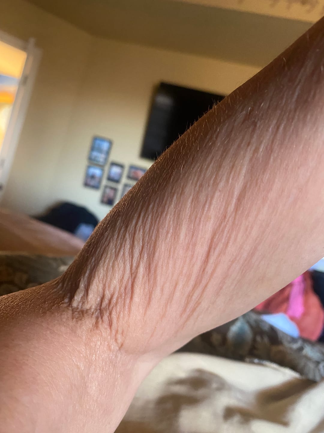 Customer photo review of Besque® Magic Body Oil - Unscented