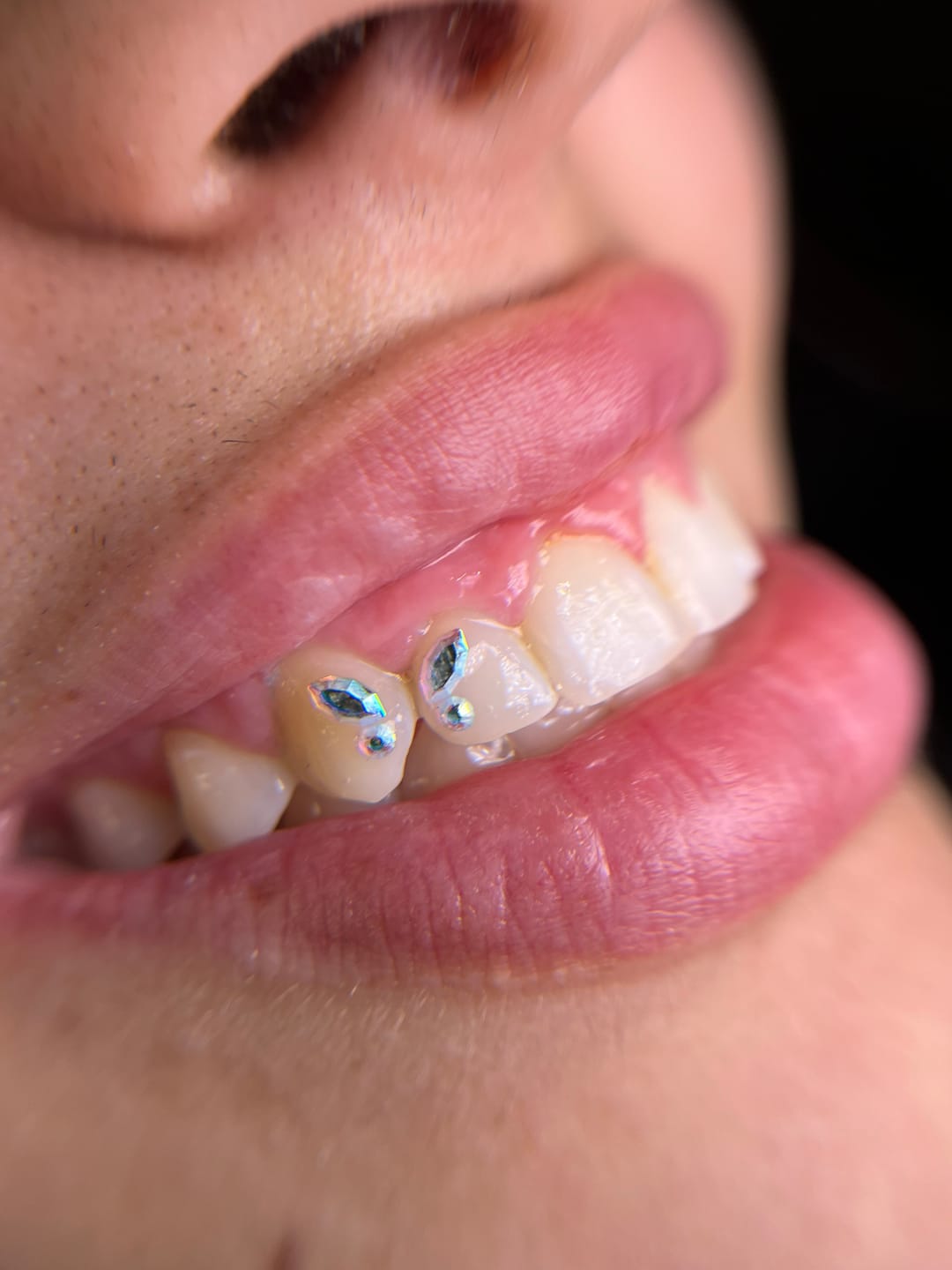 Customer photo review of Pack de 8 diseños de mariposa de gemas dentales Navette SWAROVSKI® - Crystal/Crystal AB