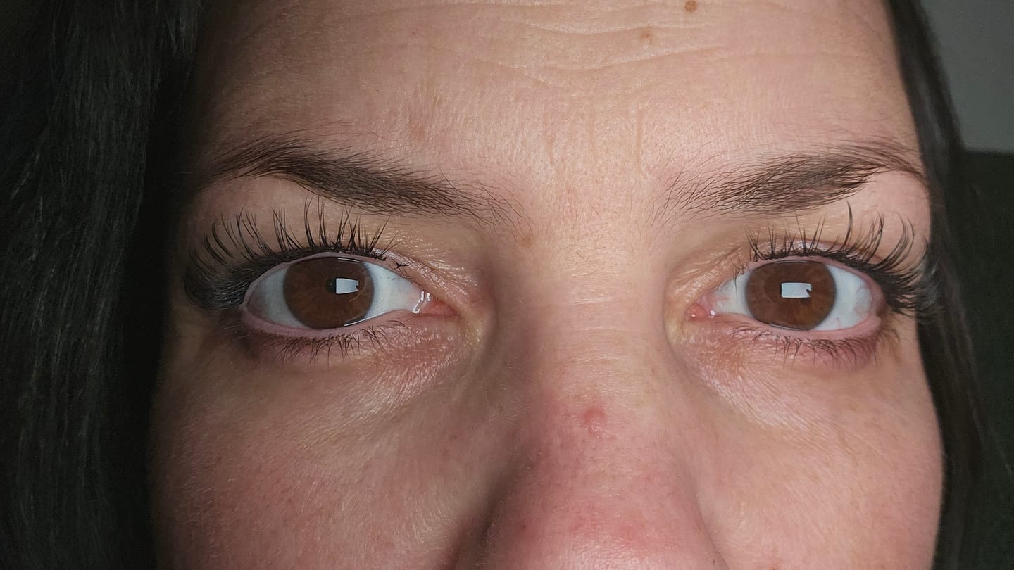 Customer photo review of THE CANCER (Krebs 5-11 mm)