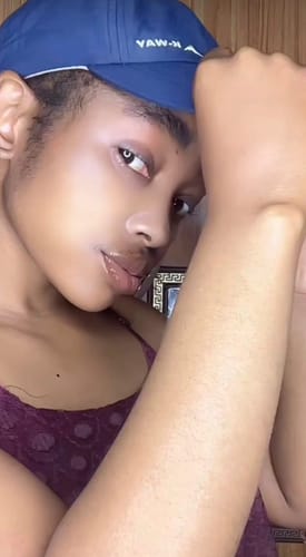 Customer photo review of Minoxidil High Strength (5%) SOLUTION, 3x60ml pack