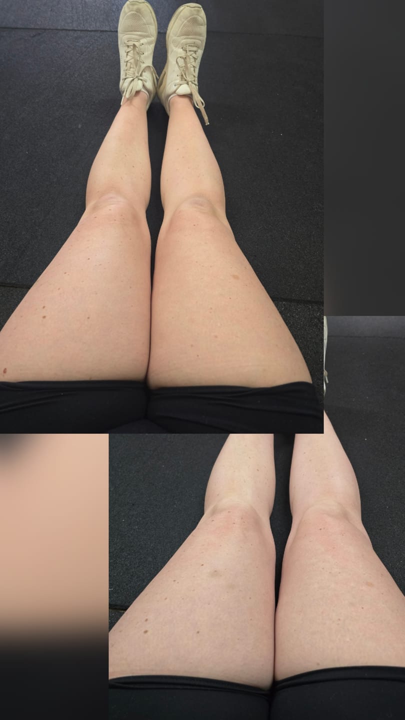Customer photo review of Self Tanning | 150 Capsules
