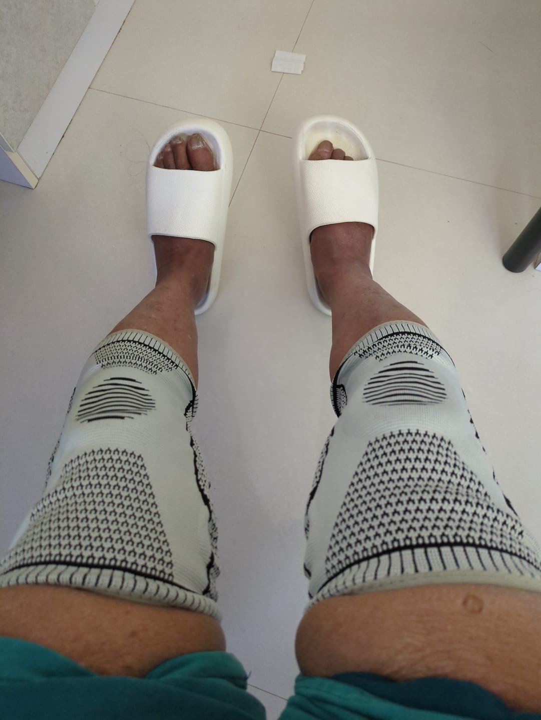 Customer photo review of Ultra Knee Elite™