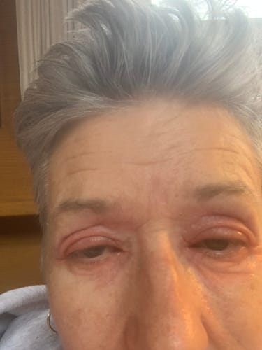 Customer photo review of Seb Natural Calming Serum