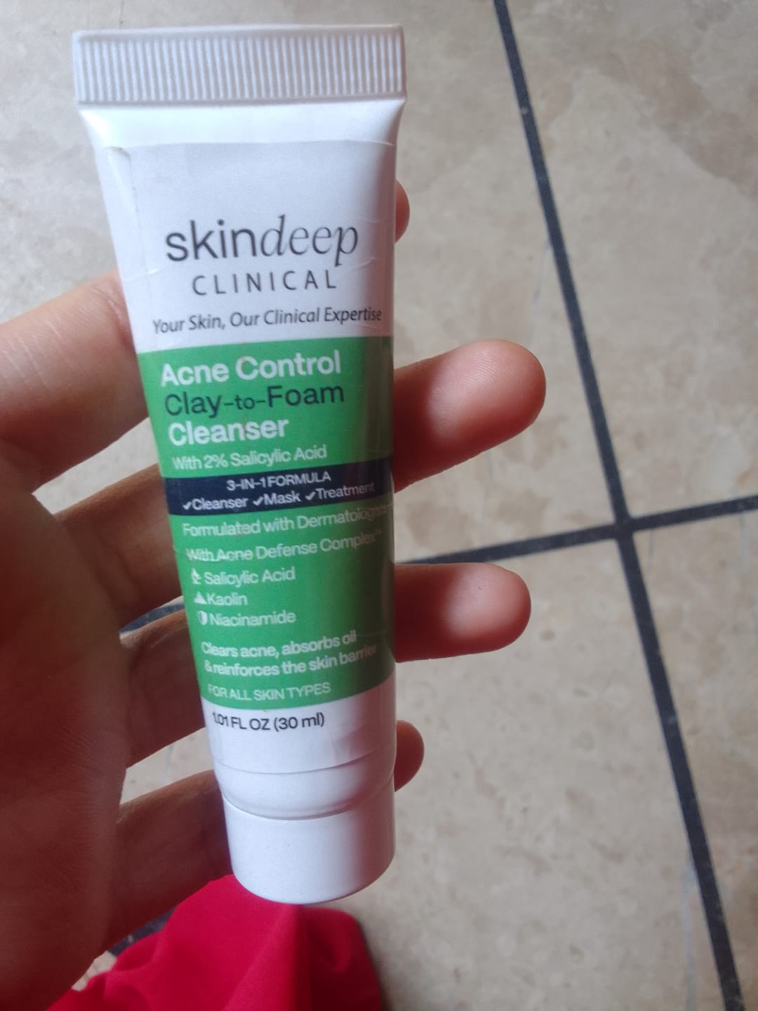 Customer photo review of Acne Control Clay-to-Foam Cleanser