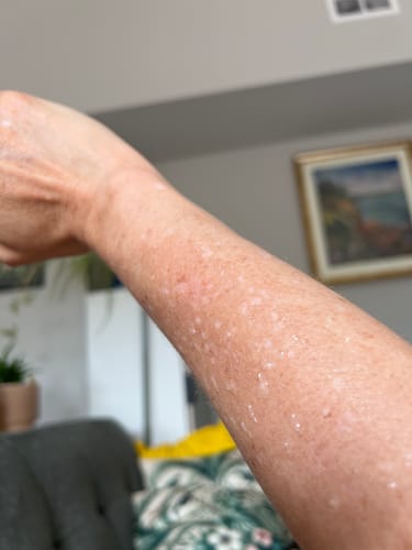 Customer photo review of Sunkind SPF 50 Mineral Sunscreen – Pre Summer 2-Pack