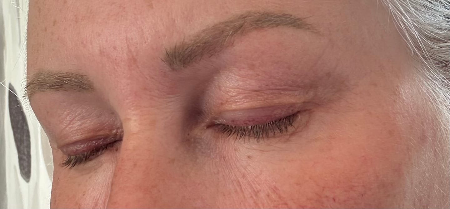 Customer photo review of Enhance® - Eyelash Growth Serum