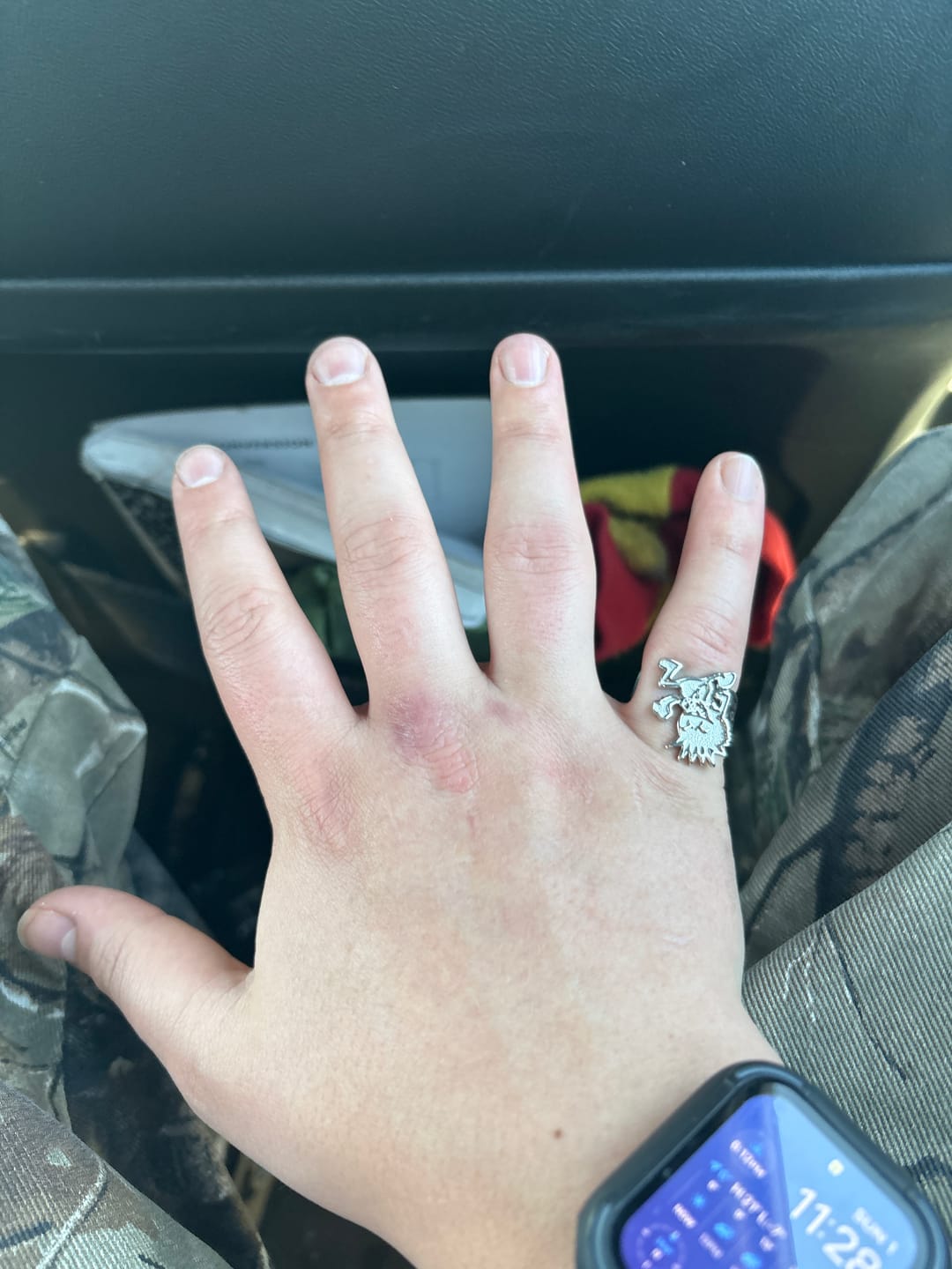 Customer photo review of HARD WILLY RING