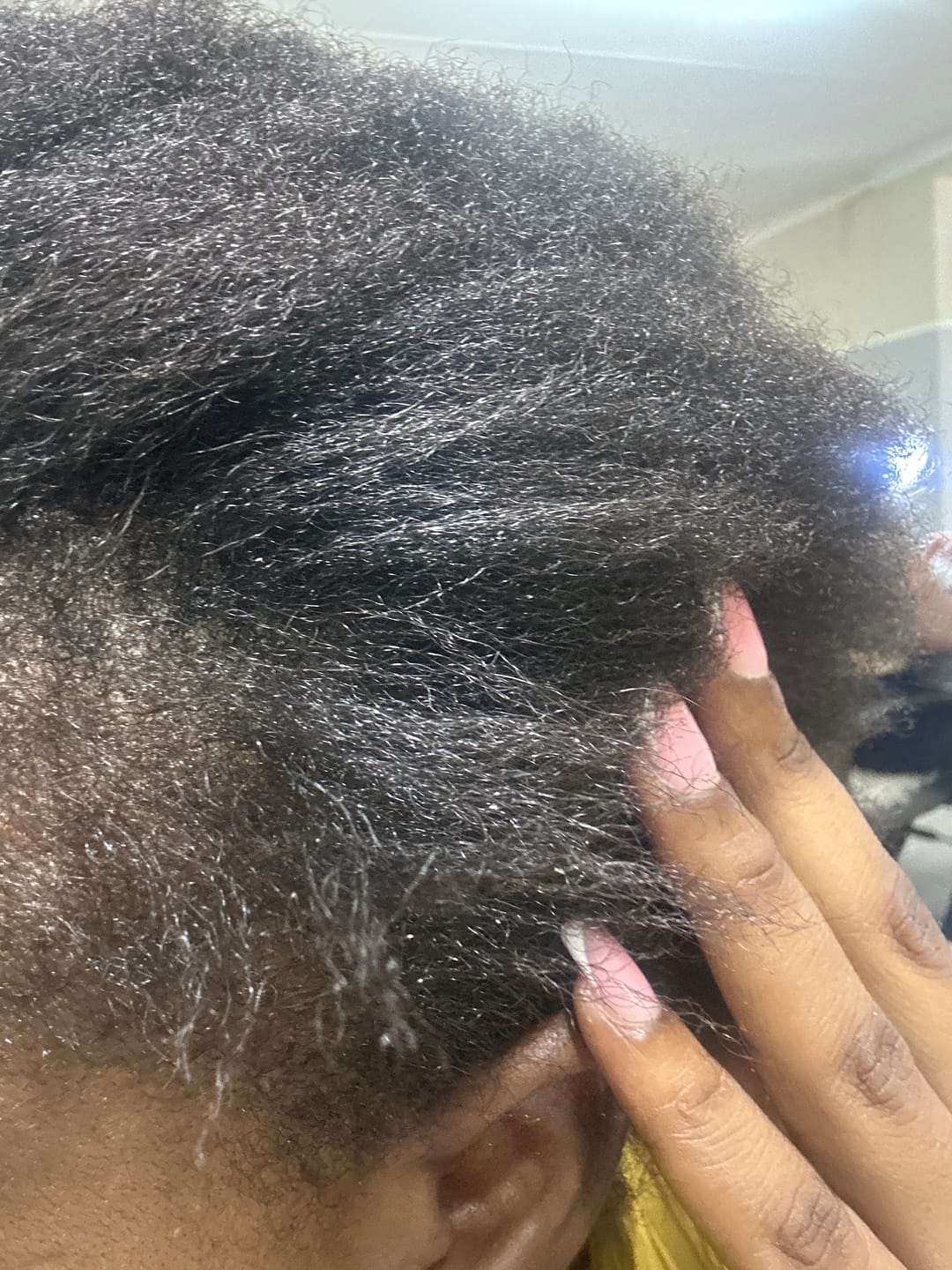 Customer photo review of Minoxidil REGULAR (2%) strength SOLUTION, 3x60ml pack