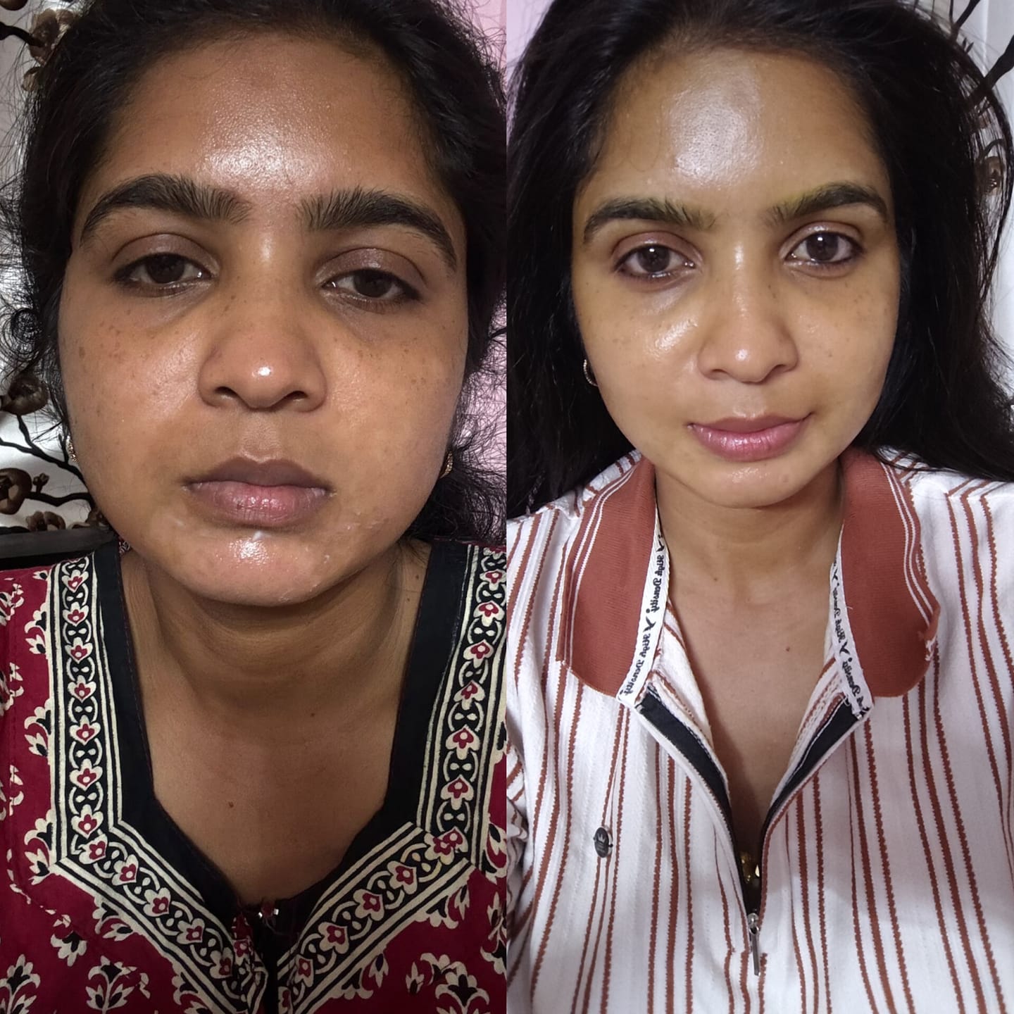 Customer photo review of Turmeric Night Repair Cream