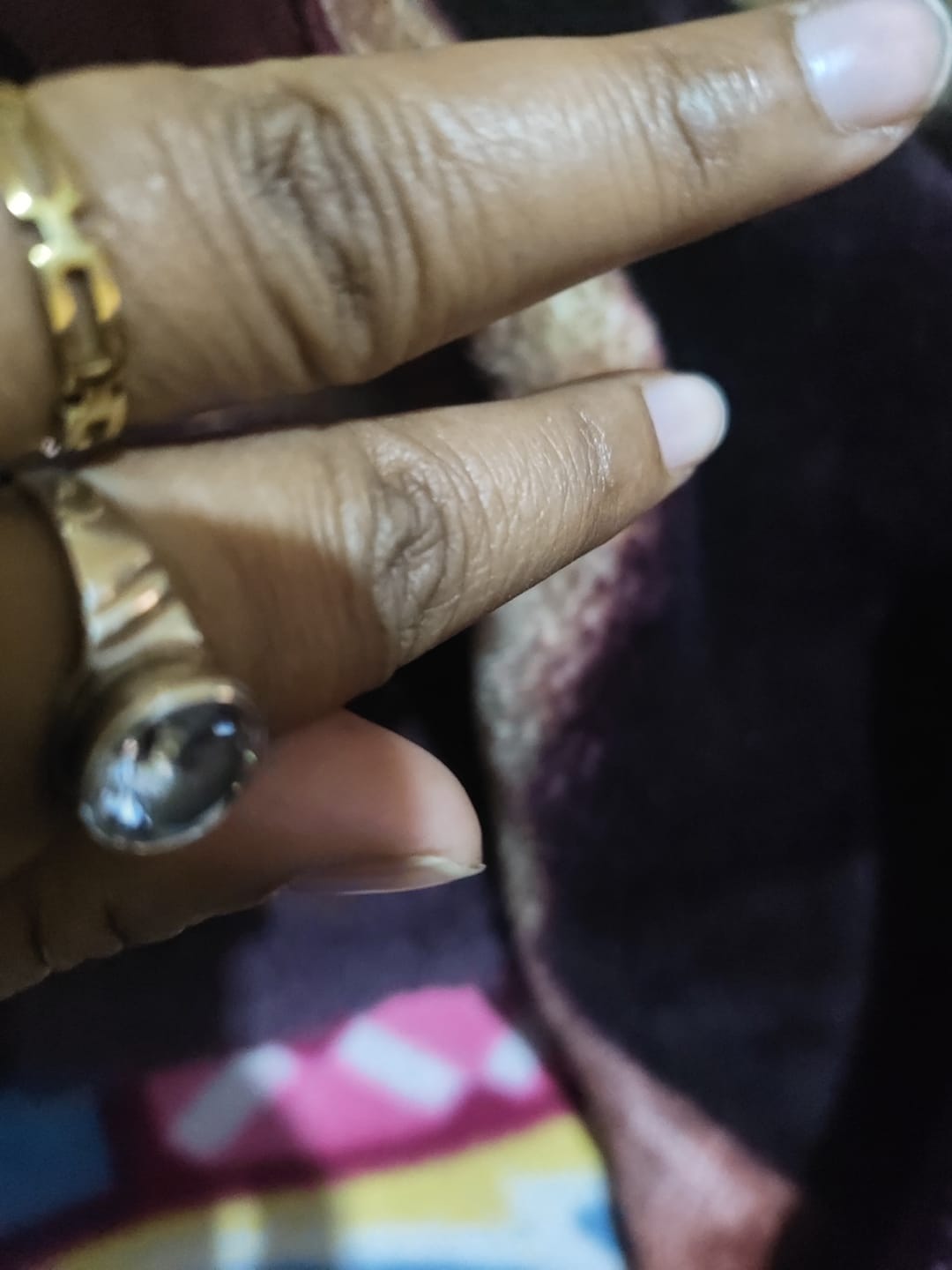 Customer photo review of Geo Link Gold Band
