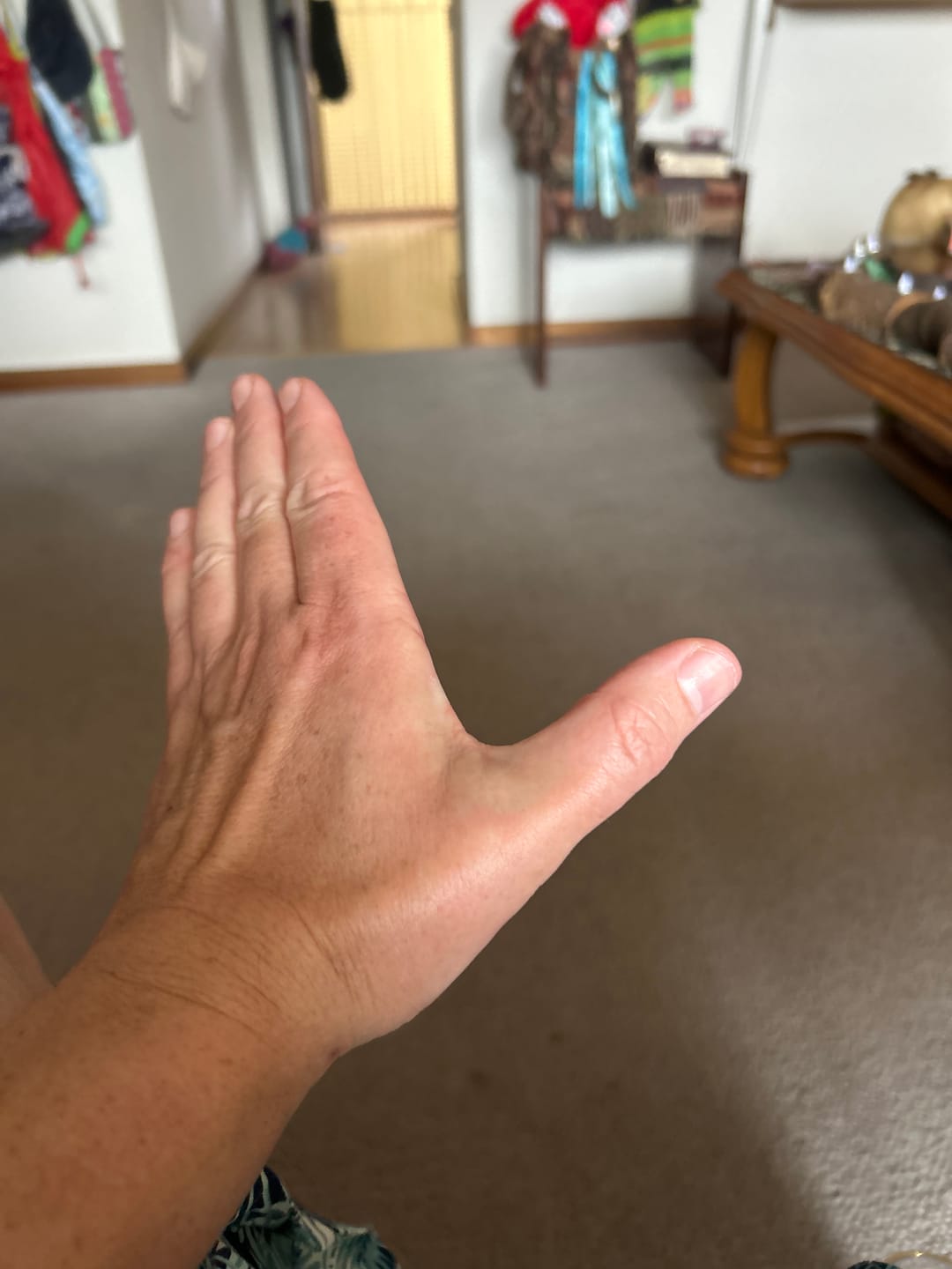Customer photo review of Uric Acid Support