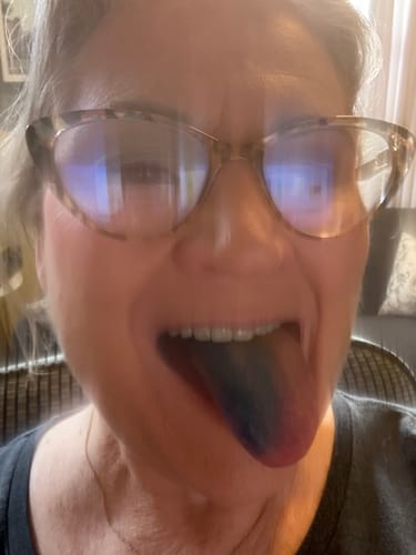Close-up of a customer's mouth, showing their tongue stained blue after taking the Just Blue™ supplement.