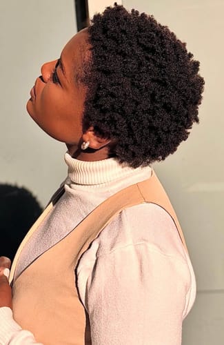 Customer photo review of Minoxidil 5% SOLUTION, 3x60ml pack