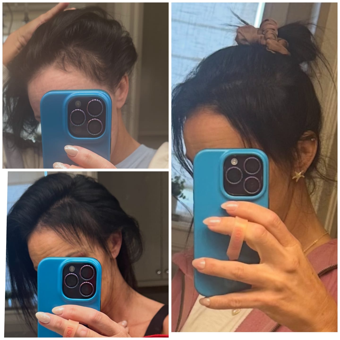 Customer photo review of Hair Growth Serum