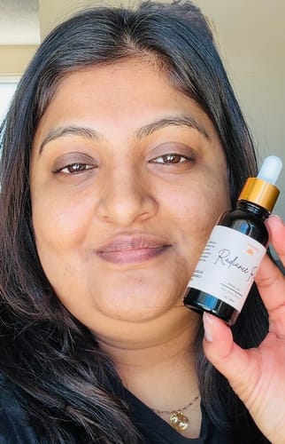 Customer photo review of Radiance Root Navel Oil 30mL/1oz
