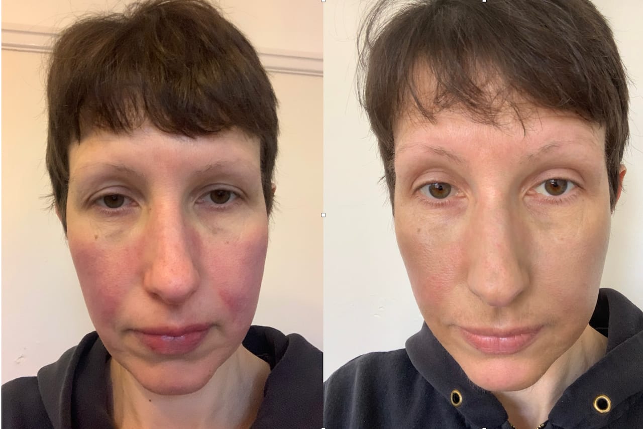 Customer photo review of The Miracle Collection