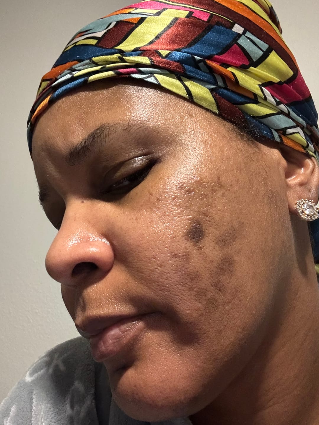 Customer photo review of Organic Turmeric Soap Bar