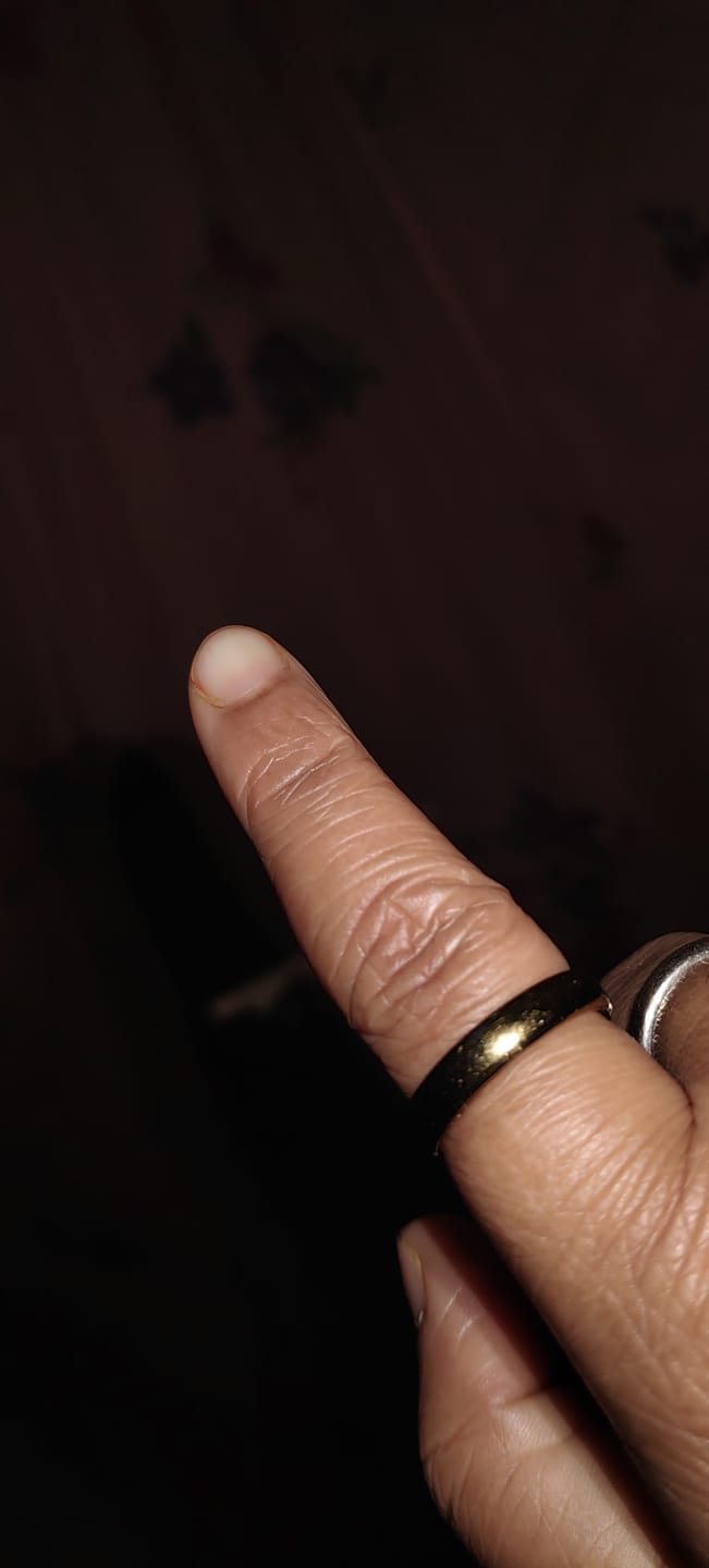 Customer photo review of Lustre Band Classic Ring