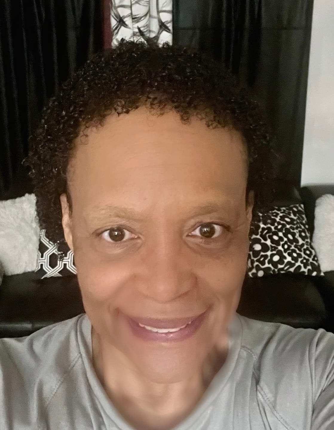 Customer photo review of Rennora Hair Growth Serum