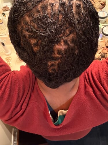 Customer photo review of Miracle Hair Growth Oil