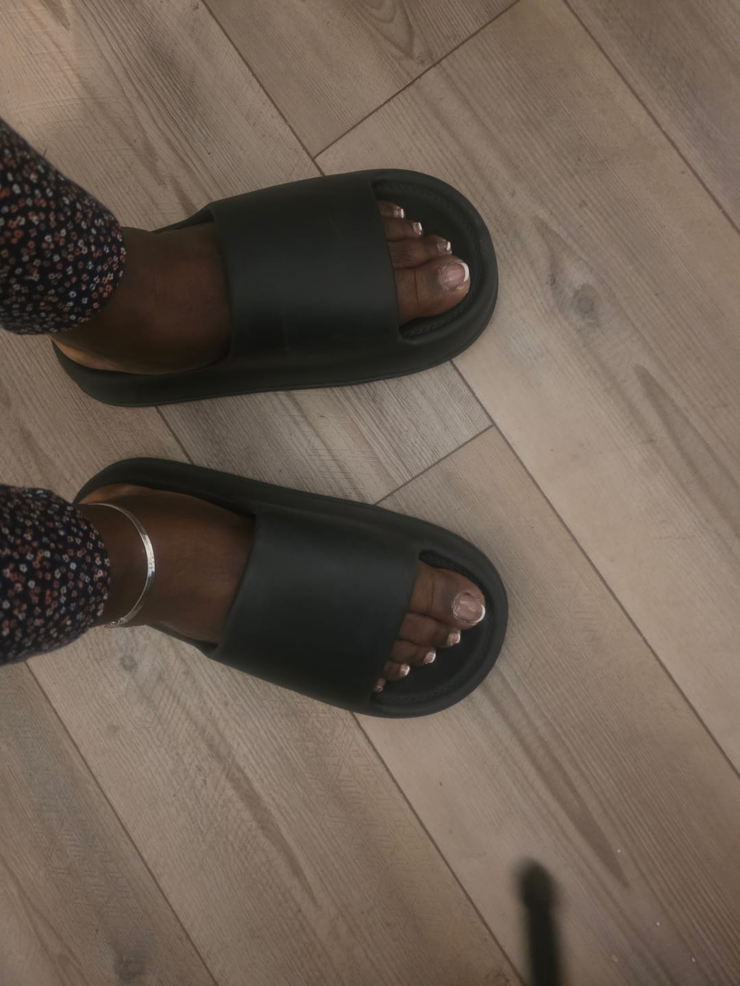Customer photo review of Cloud Slides - Men's Cushioned EVA Sandals with Adjustable Buckles