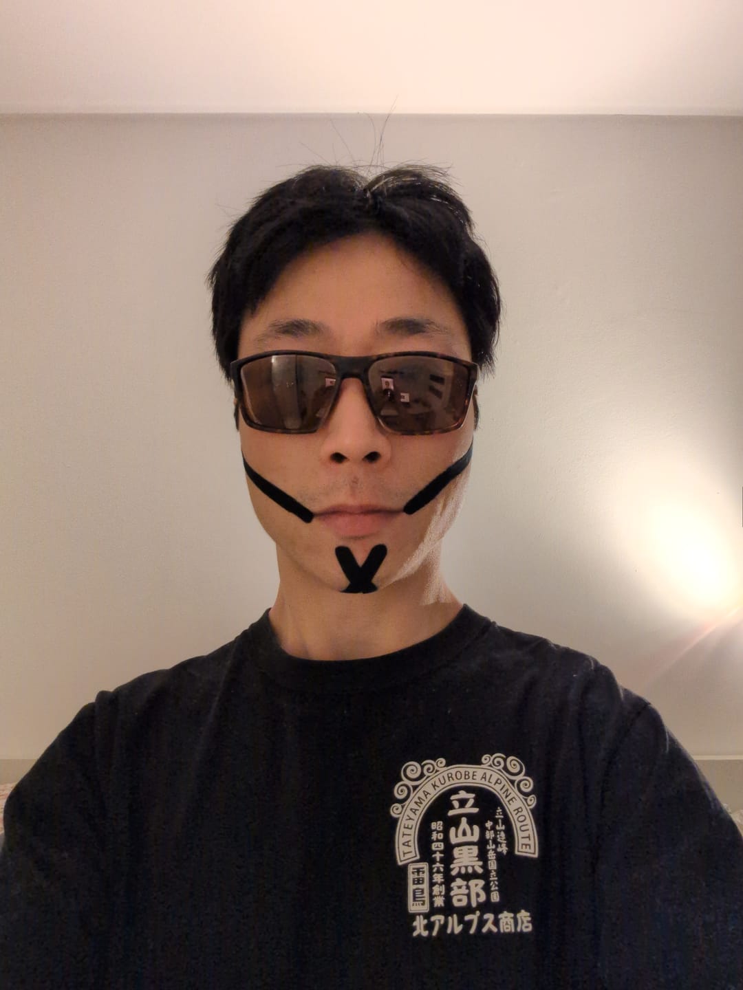 Customer photo review of Zygo Tape - Facial Sculpting & Anti-Aging Tape