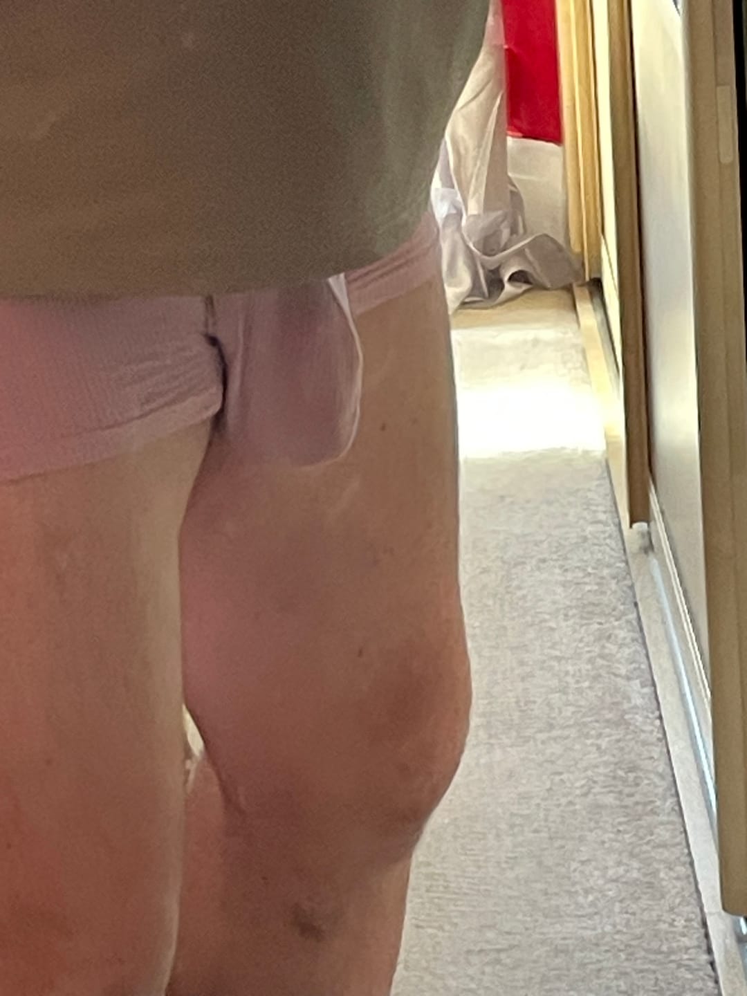 Customer photo review of 3 Pack Separate Ball Support Pouch Trunks