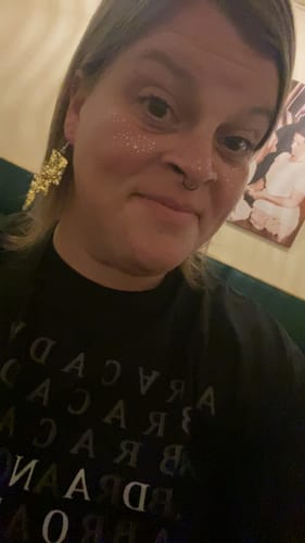 Customer photo review of Gold Glitter Freckles Makeup Patches