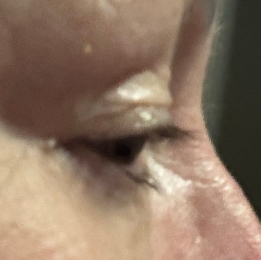 Customer photo review of NEW & IMPROVED LASH SERUM