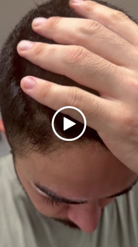 Customer video review of Pack Tratamiento Anticaspa Seca o Psoriasis en Barra