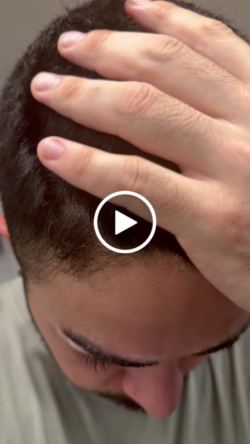 Customer video review of Pack Tratamiento Anticaspa Seca o Psoriasis en Barra