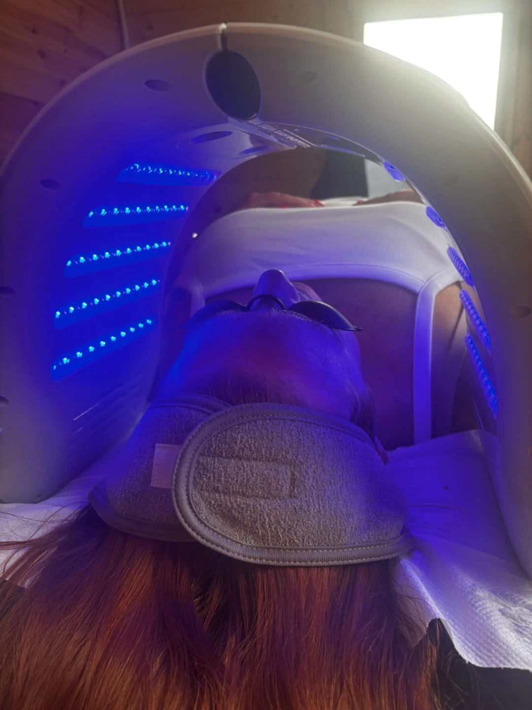 Customer photo review of 7 Colours LED Light Therapy Facial Skin Rejuvenation